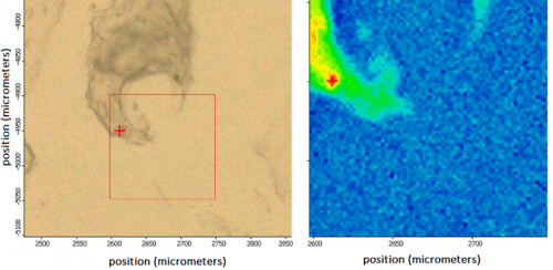 Esempio di identificazione di idrossiapatite in calcificazione di Condorsarcoma di grado 1: a sinistra una immagine della morfologia e a destra la corrispondente mappa biochimica intorno a picco identificativo dell'idrossiapatite