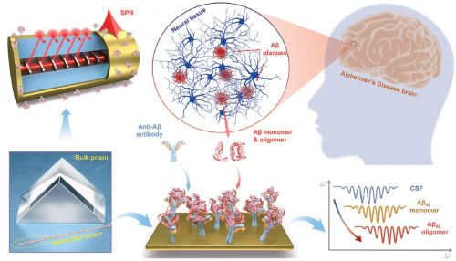 Illustrazione schematica di un sensore in fibra ottica rivestito con un film nanometrico di oro che viene utilizzato per la rilevazione e discriminazione di biomarcatori clinici in liquido cerebrospinale nella malattia dell'Alzheimer