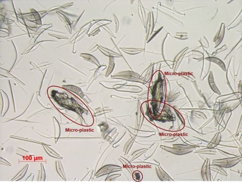 Riconoscimento automatico di micro-plastiche da micro-plankton in campioni marini