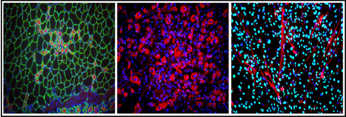 Immagini di immunofluorescenze di: un muscolo in rigenerazione (sinistra), di cellule adipose derivate dalle FAP in condizioni di controllo (centro) e di cellule muscolari derivate dalle FAP dopo inibizione di G9a/GLP (destra)