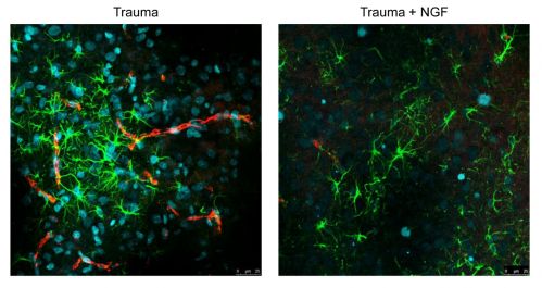 Riduzione del numero di astrociti (in verde) e microglia (in rosso) infiltrati nel parenchima cerebrale, a seguito della somministrazione di NGF per via intranasale