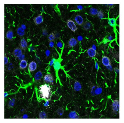 Immagine della corteccia somatosensoriale del modello murino, ottenuta al microscopio. Sono visibili gli astrociti (in verde), gli accumuli di beta-amiloide (in bianco) e i nuclei cellulari (in blu)