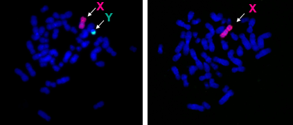  Raffigurazione dei cromosomi di due cellule, a sinistra una cromosoma Y, a destra senza