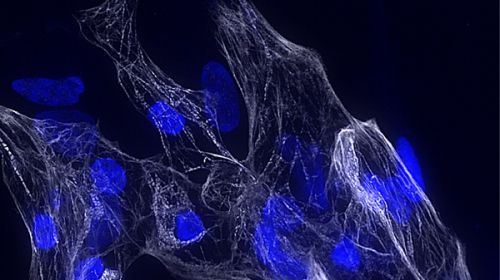 Immagine rappresentativa di cardiomiociti umani derivati da cellule staminali pluripotenti