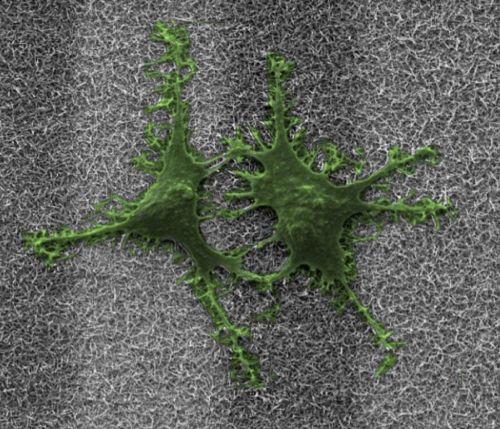 Immagine al microscopio elettronico di atrociti sui nanofili di oro e silicio