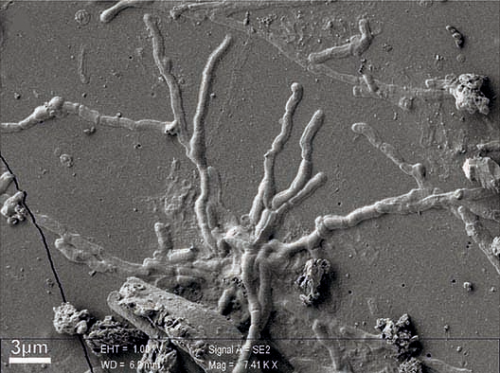 La straordinaria immagine del neurone 