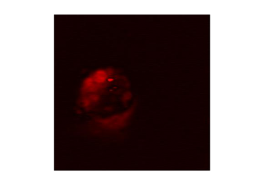 Immagine ottenuta con il microscopio ottico non lineare basato sulla spettroscopia Raman coerente