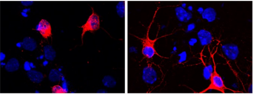 Immagine rappresentativa degli effetti benefici dell'anticorpo A13 sulle cellule neuronali (in rosso). A sinistra sono mostrati i neuroni 'malati', mentre a destra i neuroni 'curati' dall'anticorpo messo a punto dal team (fonte: rivista)