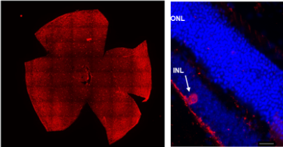 A sx, cellule amacrine dopaminergiche presenti in una intera retina. I puntini rossi a dx indicano una sez. verticale di retina in cui la cellula amacrina dopaminergica è ben evidente nello strato interno della retina